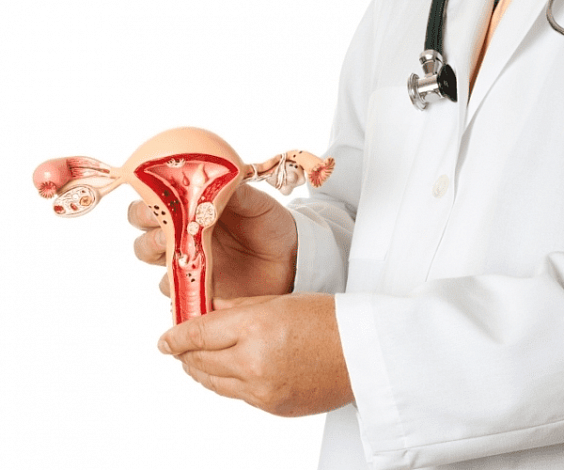 Endometrioza: cauze, simptome, tratament Ceea ce este endometrioza cu varicoză